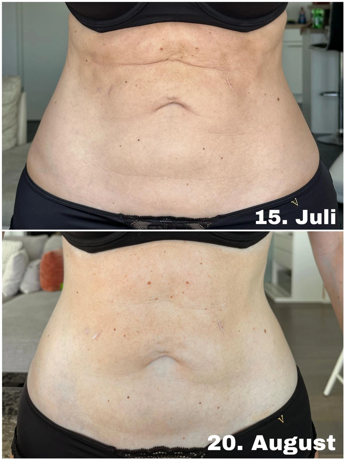 Spirit of Beauty – Beate Heinig – Wellness- und Schönheitssalon – Ergebnisse von Body Farming