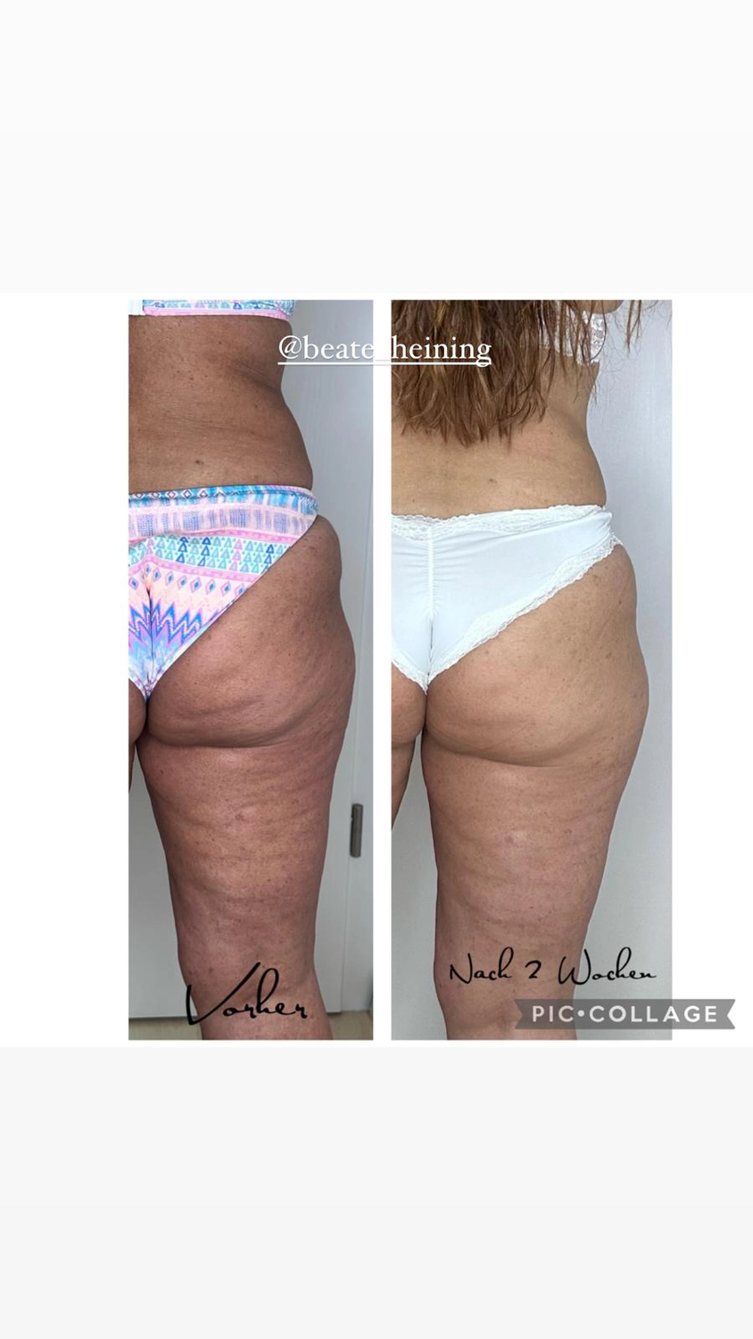 Spirit of Beauty – Beate Heinig – Wellness- und Schönheitssalon – Ergebnisse von Body Farming